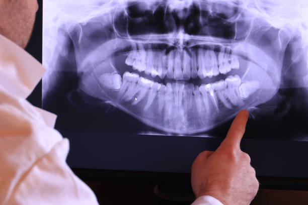 Best Emergency Root Canal Treatment in Herscher, IL